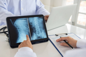 Spinal Cord Injury Lawyers In El Paso
